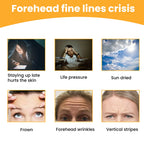 Forehead Wrinkle Patch – Lift & Smooth Care