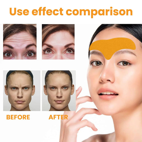 Forehead Wrinkle Patch – Lift & Smooth Care